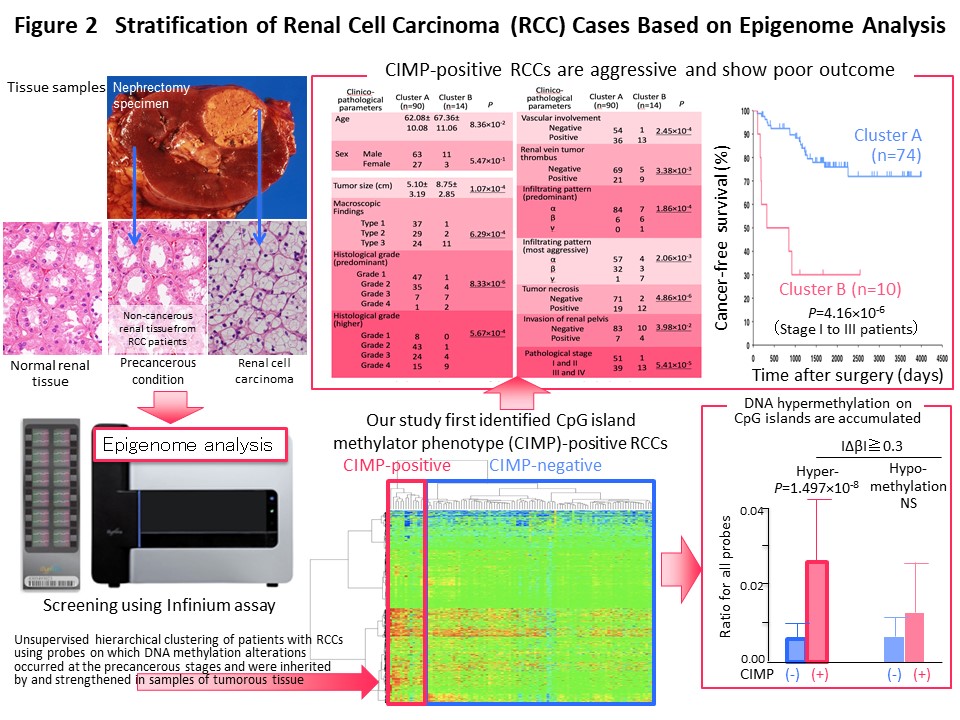 Figure 2 Stratification of Renal Cell Carcinoma (RCC) Cases Based on Epigenome Analysis

